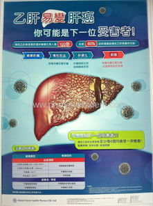 明發(fā)彩印對位吸塑制品廠